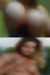 Lumenpulser, free sex